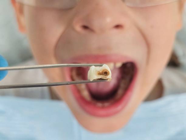 Best Urgent Dental Care in Ahwahnee, CA