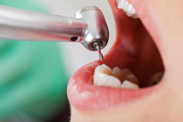 Best Emergency Treatment for Toothache in Ahwahnee, CA